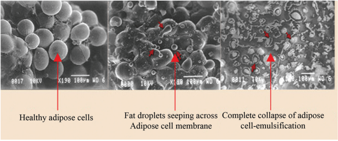 扫描电子显微镜(sem)图像脂肪细胞,可以看到在照红光后脂肪被带走