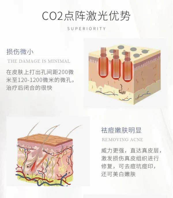 二氧化碳点阵的几种模式都是啥?哪个祛痘坑更高效?_激光