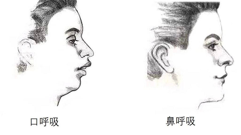 研究表明习惯用嘴呼吸得不到更多氧气只会让人变丑