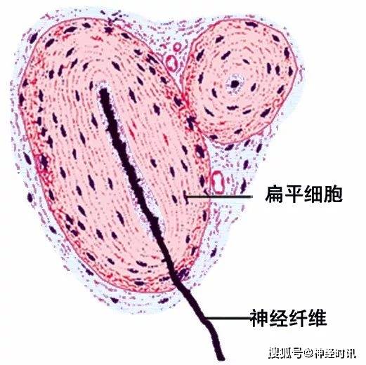 (1)躯体运动神经末梢(又称运动终板,分布于骨骼肌.