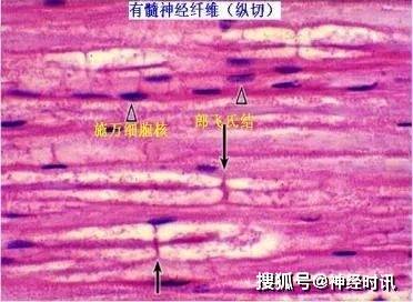 无髓神经纤维由较细的轴突和包在它外面的神经膜细胞组成,不形成髓鞘