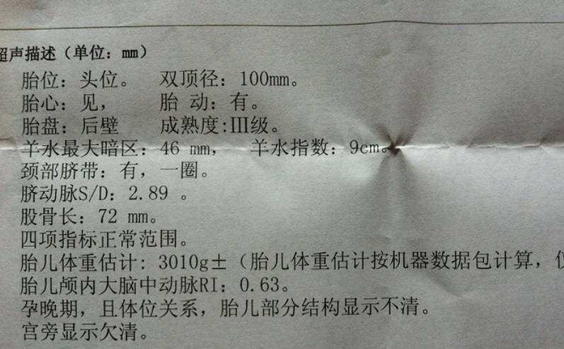 其实在做产检的过程当中,在b超单子上有一项非常重要的数据,那就是