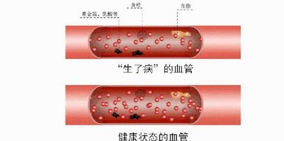 我们的血管长期运输血液,如果缺少蛋白质,维生素c,维生素e,钙当中的