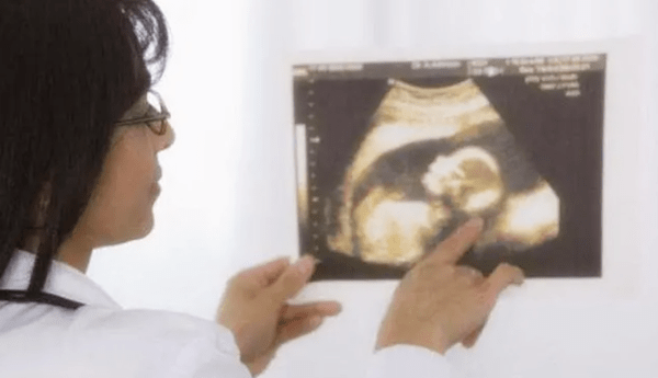 胎兒的四肢幾個月能長全？這個階段更容易發育畸形,孕媽要注意