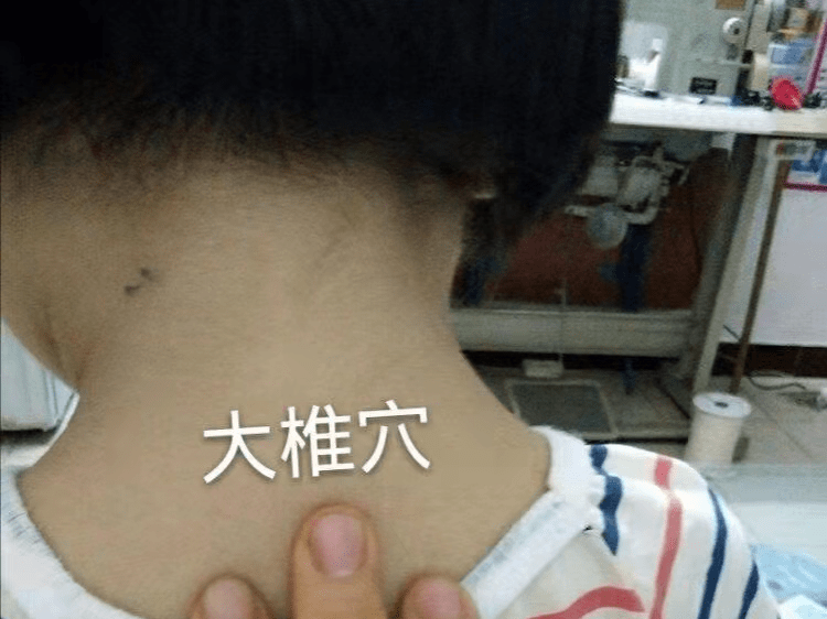 吹风机吹大椎穴,后背脖子低下头凸起的那个穴位就是大椎穴,调到合适的