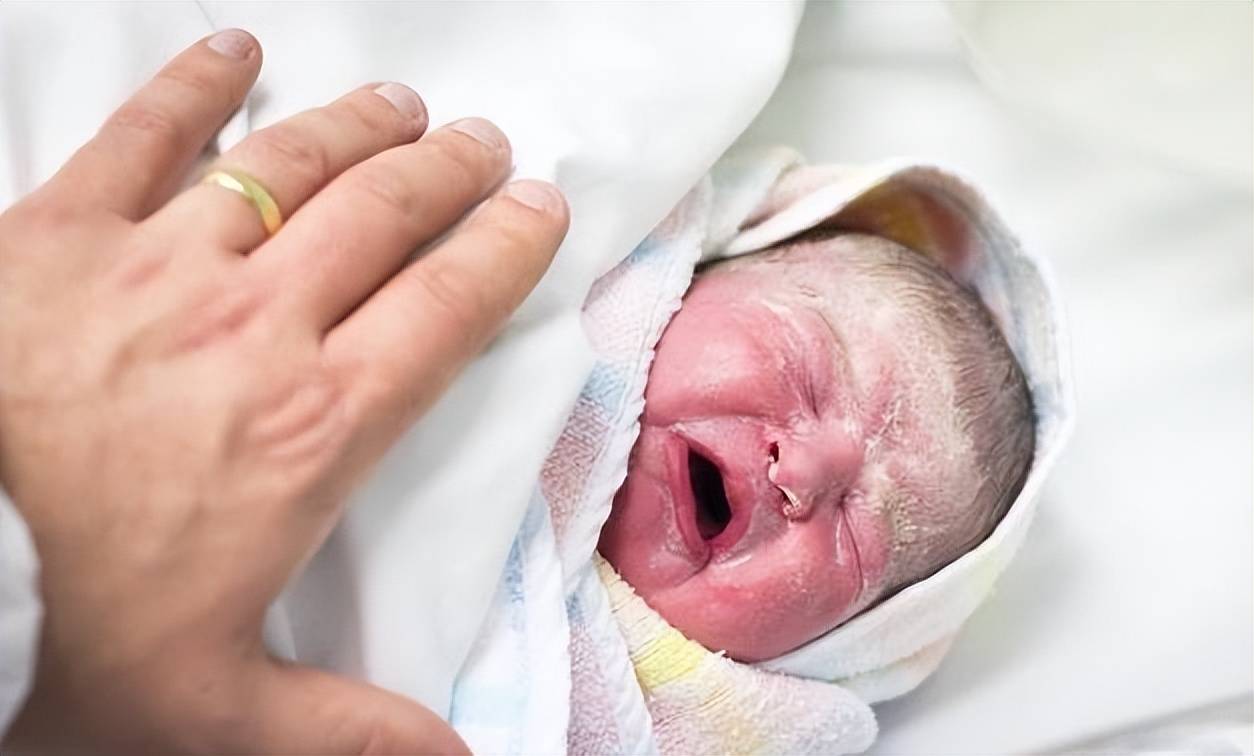 胎儿＂一袭白衣＂出生，很多宝妈都不忍直视,并非是不祥的征兆