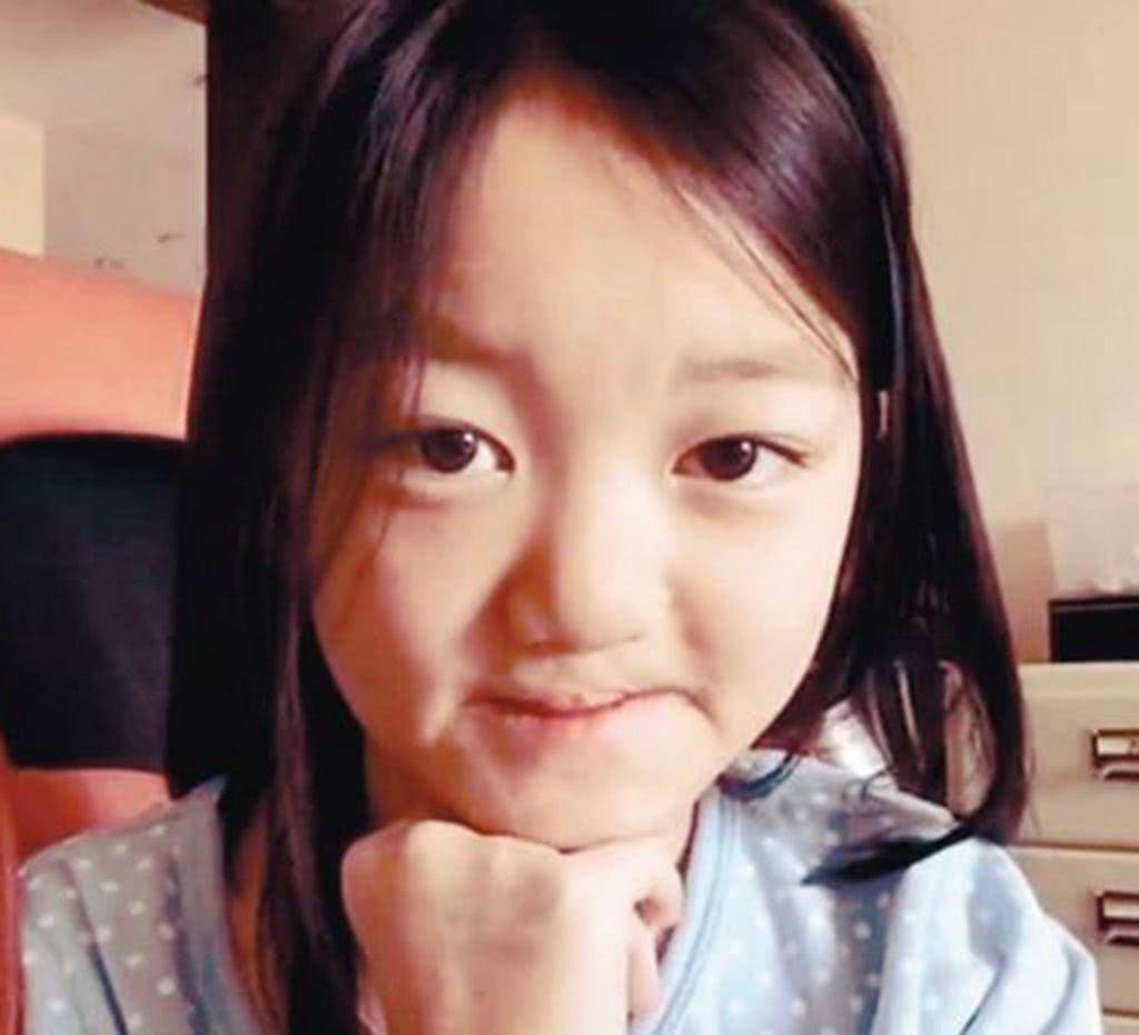 她生下女儿李嫣,怎奈命运不公,李嫣一下生就是个"兔唇"女孩