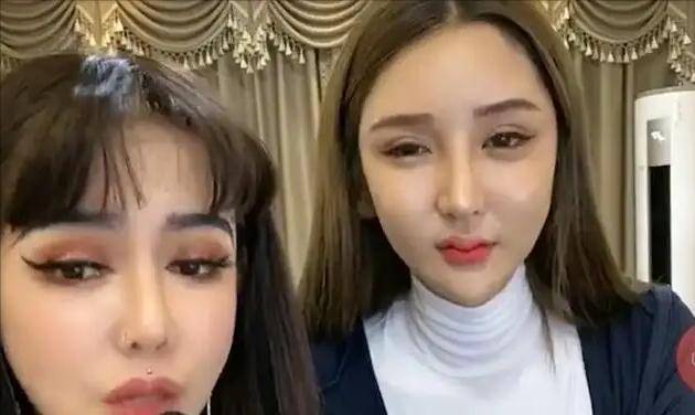 原创桃花宝宝花上百万整容前后模样对比太吓人网友亲妈都不认识