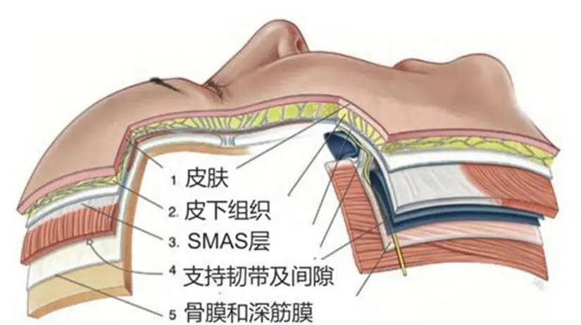 郑在佑院长为你揭秘什么是smas筋膜层