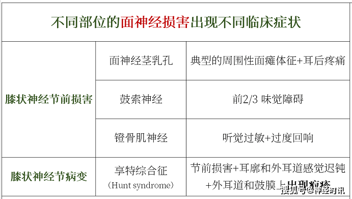 这4点要知道_神经炎_面神经_患者