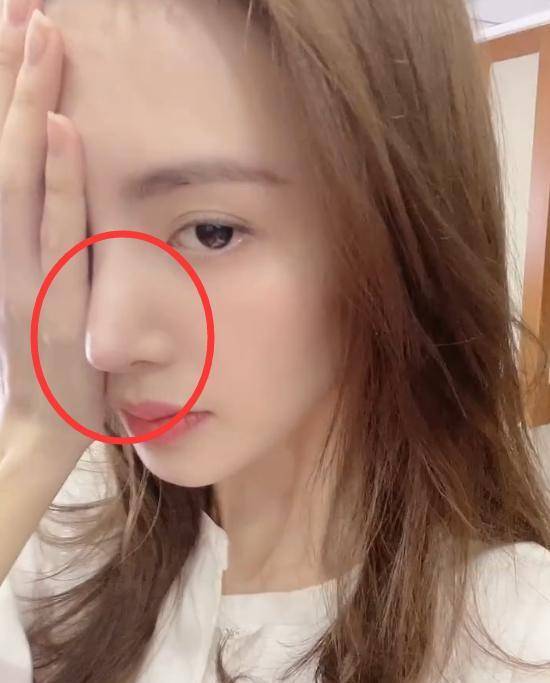 金晨回应鼻子"透光,全程捂着半边脸,看清她的眼,真被吓到了_视频