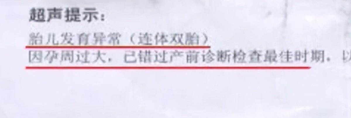 为什么医院当初做b超时没有发现?