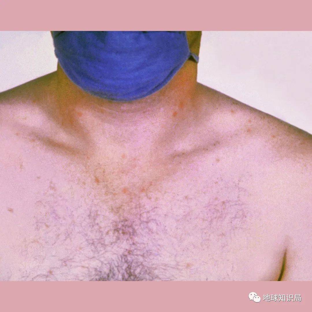 Ϊʲô����Ȧ��ô���ˡ��ס��ˣ�| ����ѧ�ʾ�