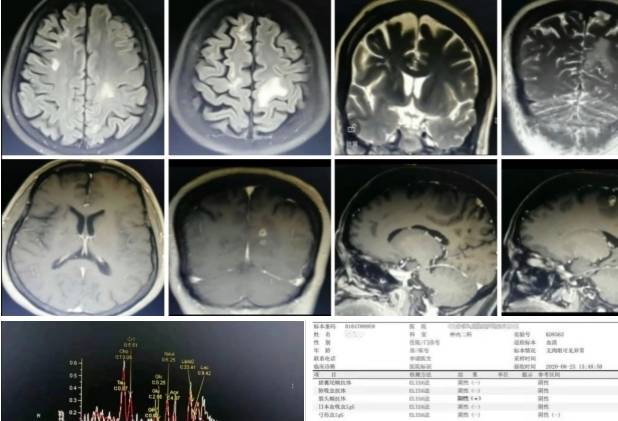 �Լ����没���͹�ע�Թ��������׶������ۺ���ح3���Ӷ�Ƭ ...