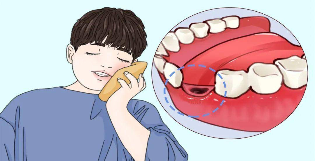 梦境的隐喻，解析梦见掉牙——我梦到自己牙掉了两次，一次一颗，二次两颗的深层含义