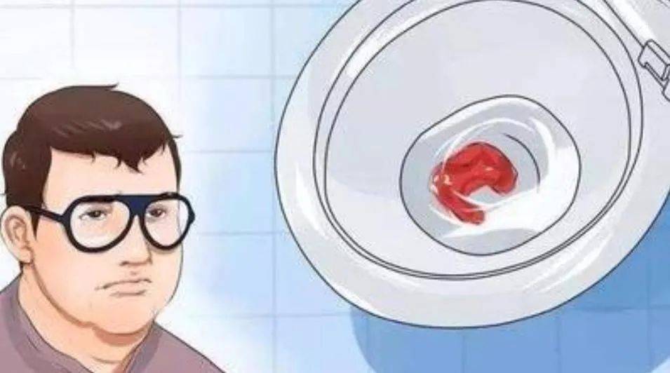 ​痔疮大量出血怎么办?别急,专家告诉你简单实用的方法！