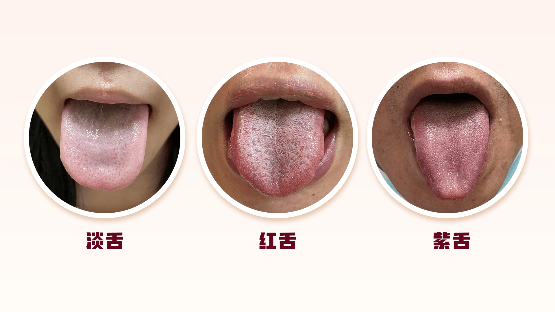 体内有病，舌头先知？医生提醒：这些变化可能暗示脏腑出现疾病_状况_舌苔_颜色