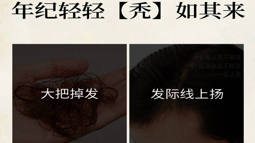 女人脱发严重怎么办用什么好？真的有用呢