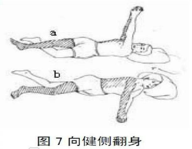 简单实用!最全卧床病人翻身技巧