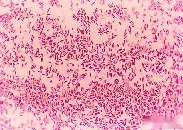 图片为大肠杆菌经过染色后选取.5,原虫病的检测:弓形虫,球虫.
