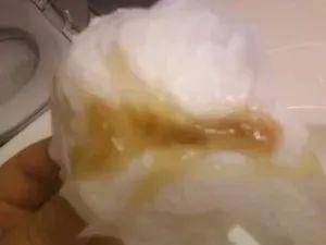 『颜色』99%的妈妈都不知道！宝宝鼻涕是这个颜色要立刻去医院
