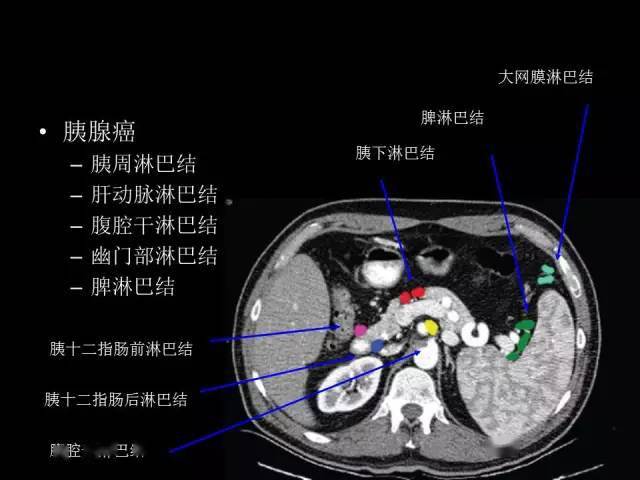 【收藏】全腹部高清ct图谱,淋巴结彩色图谱,血管解剖图谱大汇总!