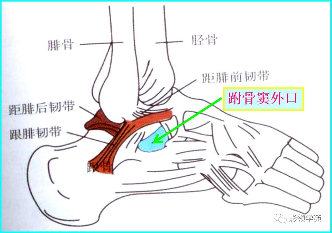 跗骨窦:三个关节面与距骨下端相应关节面相连接.