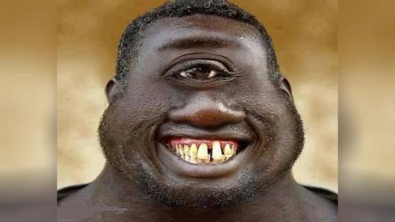 世界上竟然有长相这么奇怪的人,真不可思议