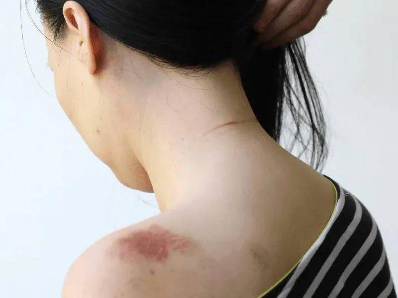 妈妈群聊新冠起分歧，澳洲两华女线下“约架”