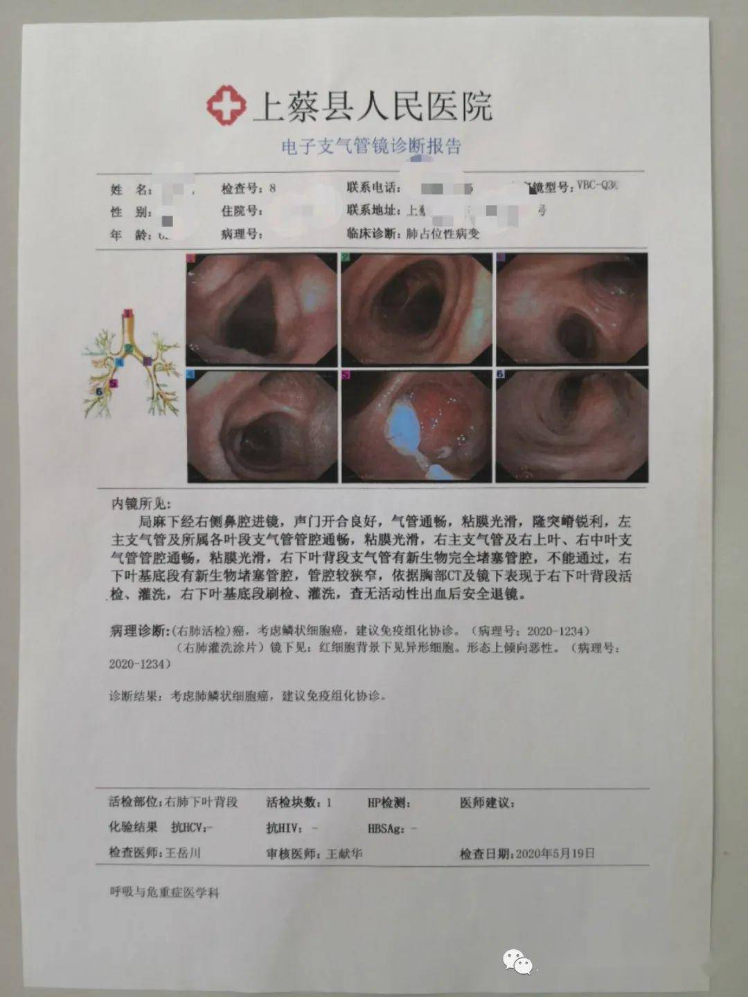 医院检查报告单怎么开 c52b86516ea540148e5782362c944ebb.jpeg