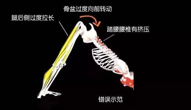 怎么拉伸腰部下方脊椎 89f67d742f4f474ab72e8057f76fdf7a.jpeg