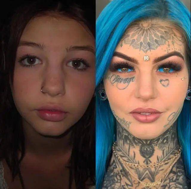 澳洲女孩挑战"眼球纹身",称"像是玻璃碎片在揉我眼睛"