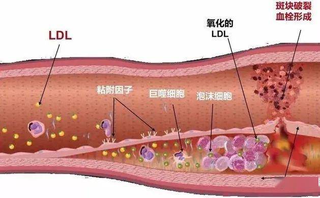 脂肪是怎么从身体里出去的 4757de60f13643d3b604e76ca4cc0717.jpeg