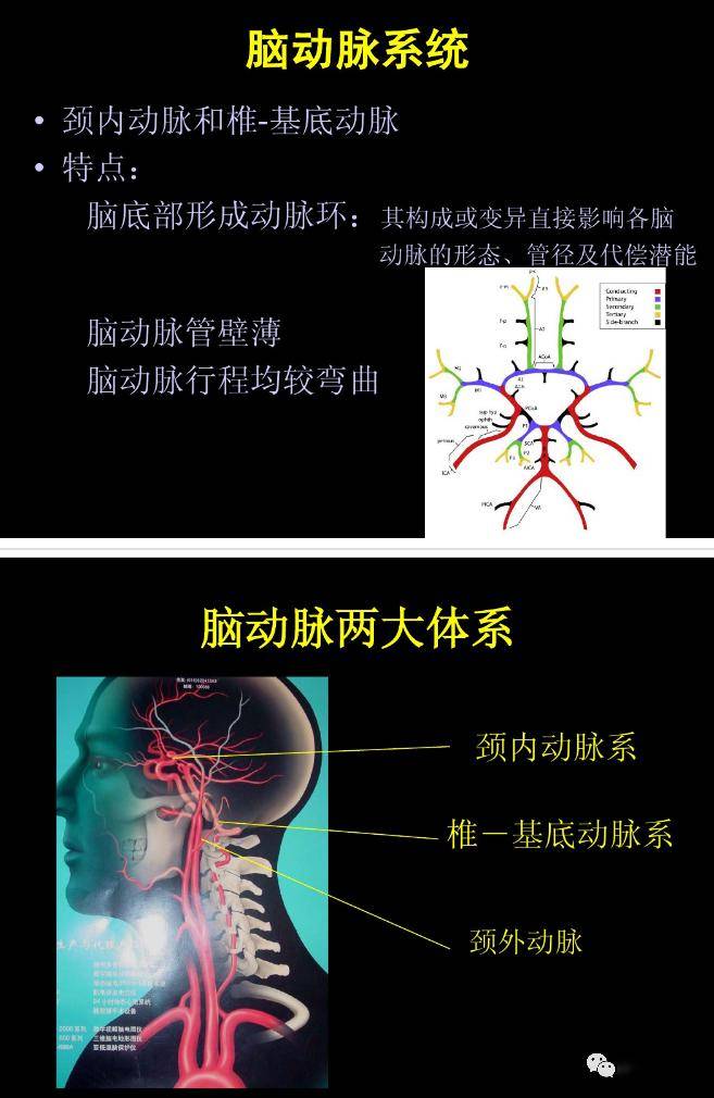 图解脑动脉的正常变 