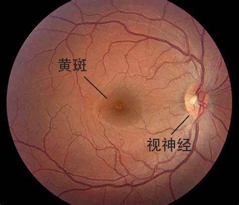 眼底示意图