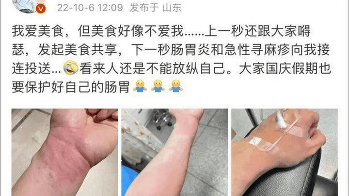 你有对某些食物过敏吗?