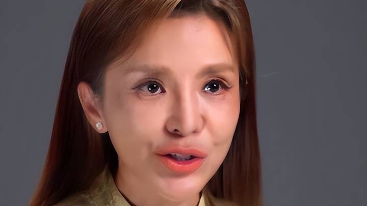 50岁朱迅近照大变样,嘴歪脸僵眼窝塌陷,是整容失败吗?