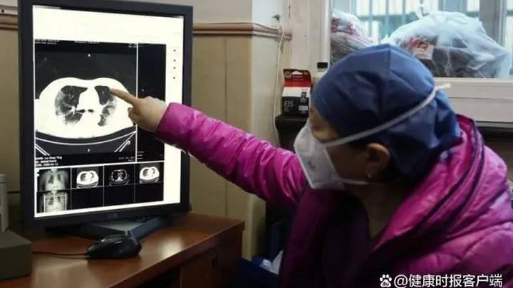 肺部ct检查需求暴增,医院值得信任吗?