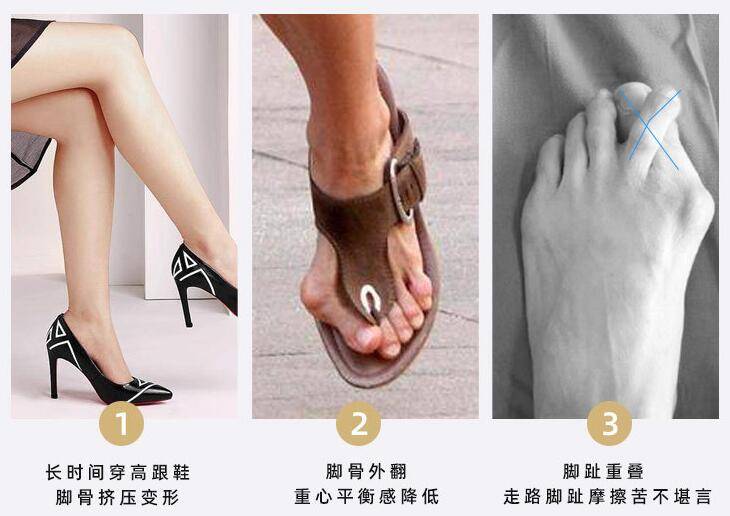 牛江红:关于拇外翻穿鞋,有几点小建议_鞋子_高跟鞋_cm