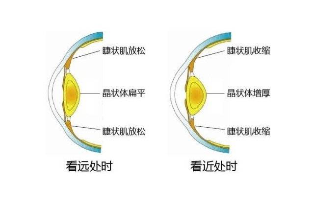 训练睫状肌对眼睛有那些益处？