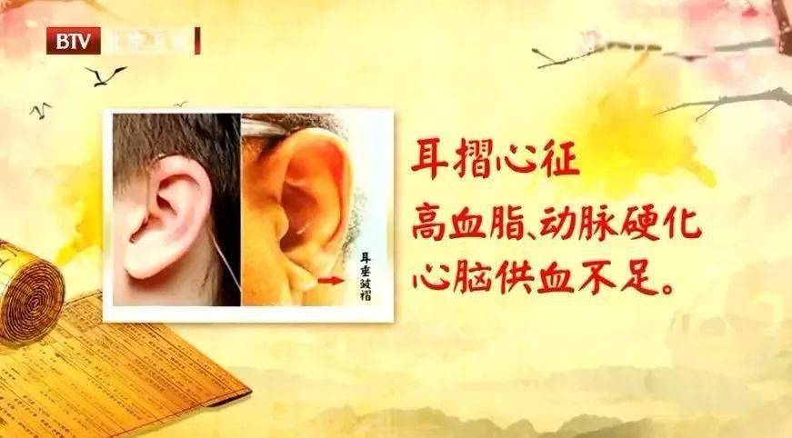 例如,耳垂上出现褶痕,可能反映了血脂高,血液粘稠度高,心脑供血不足的