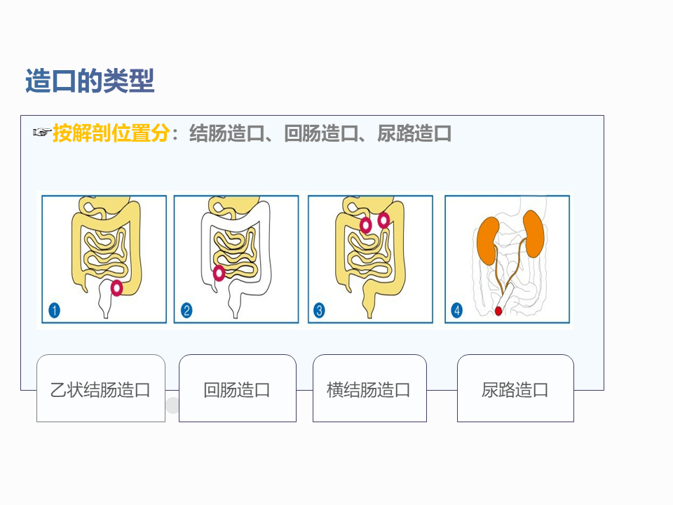 一例结肠癌术后肠造口缺血坏死护理查房