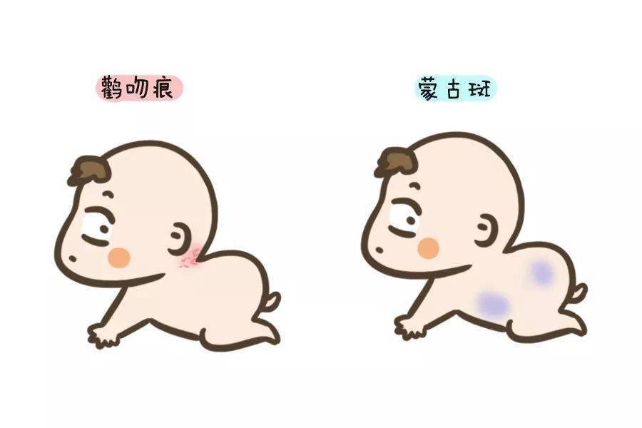宝宝皮肤上的这些常见问题不是病,不需要治疗!