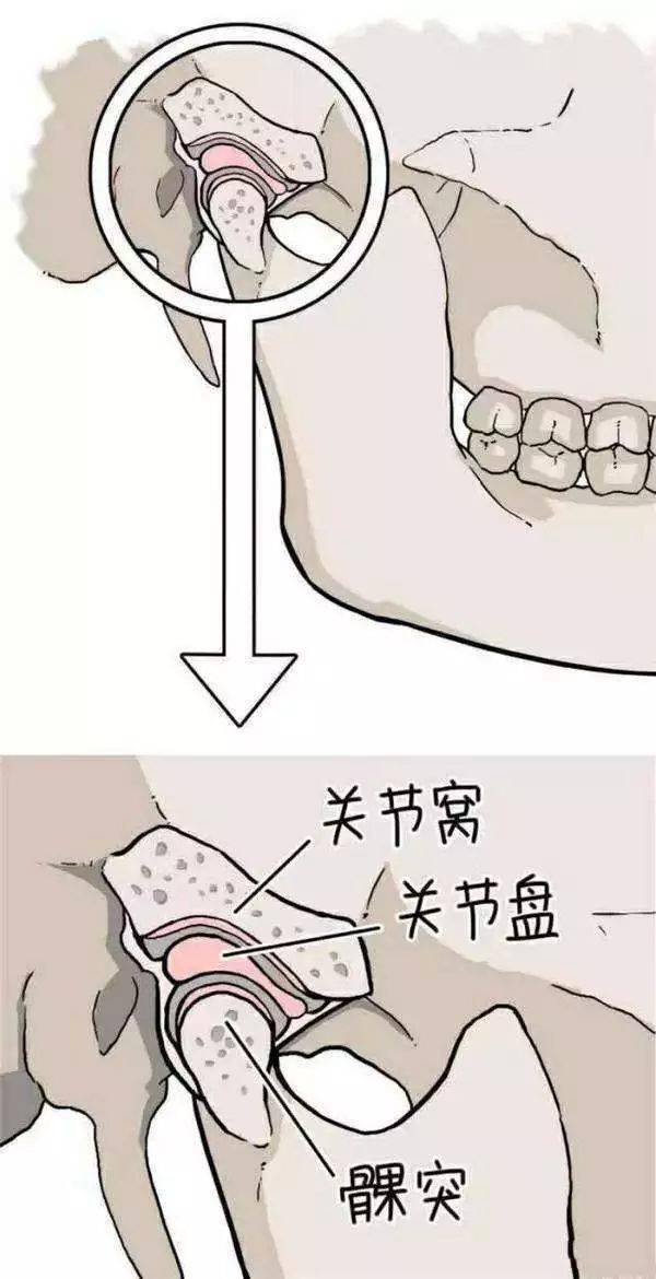 一个是下面的髁(kē)突,也就是下巴部分的骨头;一个是上面的关节窝.