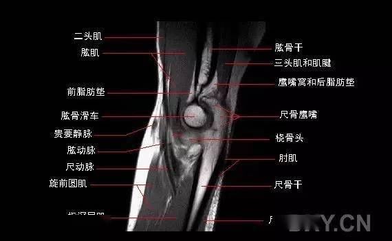 影像解剖肘关节mri图谱超全整理