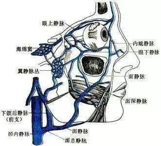 进入海绵窦并引起颅内海绵窦血栓性静脉炎