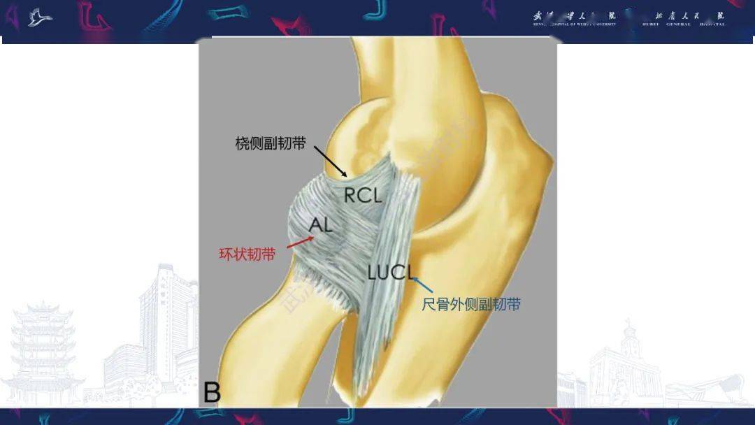 肘关节mri解剖及侧副韧带复合体常见损伤下