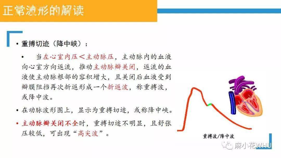 如何做好有创动脉血压监测及其波形分析?史上最详细的