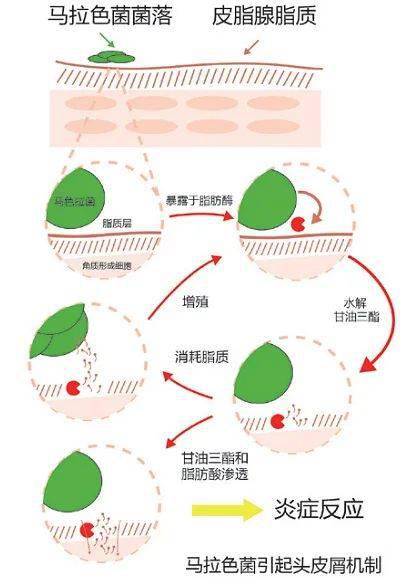 李佳琦推荐的脱发克星!一次就能拯救头屑头痒头油,用了它头发都会跳舞!