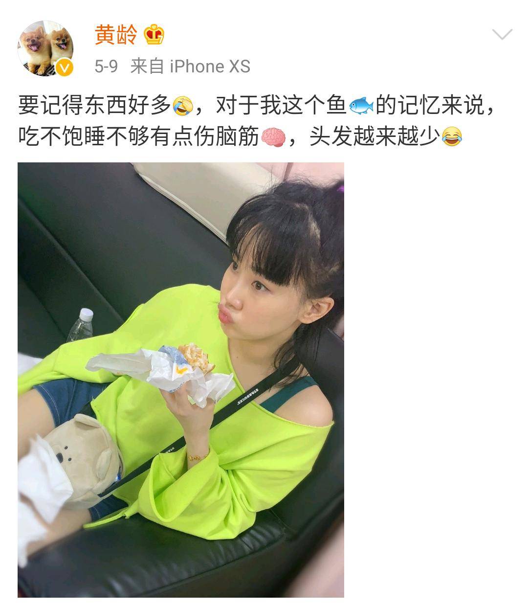 李佳琦推荐的脱发克星!一次就能拯救头屑头痒头油,用了它头发都会跳舞!